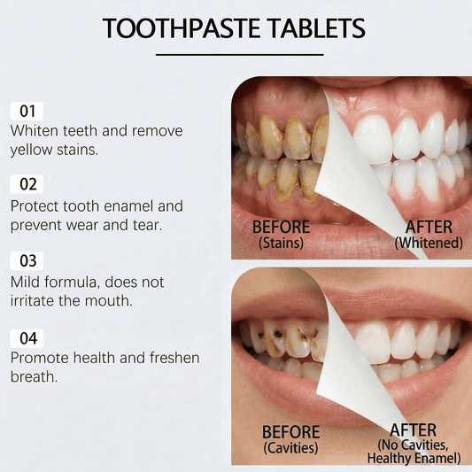 NOBS - Enamel Protection Toothpaste Tablets - WellnessAura